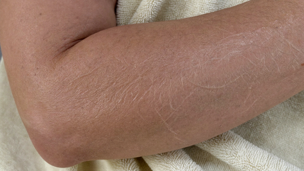 Close up of medium wheatish Pakistani skin tone on a forearm in natural daylight